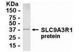 Western Blotting (WB) image for anti-Solute Carrier Family 9, Subfamily A (NHE3, Cation Proton Antiporter 3), Member 3 Regulator 1 (SLC9A3R1) (AA 240-358) antibody (ABIN2468021)