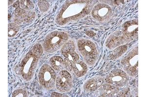 IHC-P Image MCCC2 antibody [N1C1] detects MCCC2 protein at mitochondria in mouse cervix by immunohistochemical analysis. (MCCC2 Antikörper  (Center))