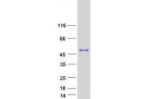 Western Blotting (WB) image for GNAS Complex Locus (GNAS) (Transcript Variant 3) protein (Myc-DYKDDDDK Tag) (ABIN2722095)