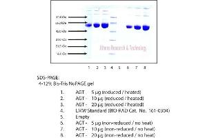 SDS-PAGE (SDS) image for Angiotensinogen (serpin Peptidase Inhibitor, Clade A, Member 8) (AGT) protein (ABIN3119643)