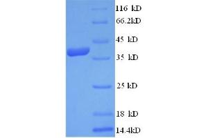 SDS-PAGE (SDS) image for Annexin A1 (ANXA1) (AA 5-346), (partial) protein (His tag) (ABIN5712858) (Annexin a1 Protein (AA 5-346, partial) (His tag))