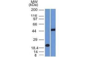 Western Blot Analysis (A) Recombinant Protein (B) Raji cell lysate Using PAX8 Mouse Monoclonal Antibody (PAX8/1492). (PAX8 Antikörper  (AA 60-261))