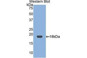 Western blot analysis of the recombinant protein. (RBP2 Antikörper  (AA 1-134))