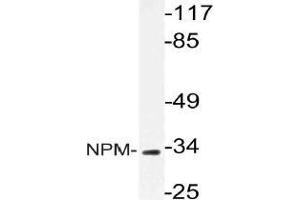 Western blot (WB) analysis of NPM antibody in extracts from HeLa cells. (NPM1 Antikörper)