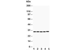 Western blot testing of CD40L antibody and Lane 1:  MCF-7;  2: HeLa;  3: Jurkat;  4: HMY2;  5: COLO320;  Predicted size: 29KD;  Observed size: 29KD (CD40 Ligand Antikörper  (N-Term))