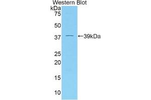 Western blot analysis of the recombinant protein. (DKK4 Antikörper  (AA 37-141))