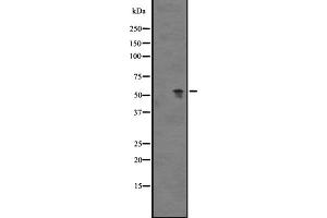 Western blot analysis of GPR89A expression in Human fetal heart lysate ;,The lane on the left is treated with the antigen-specific peptide. (GPR89A Antikörper)