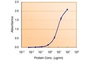 Image no. 3 for anti-Glucose-6-Phosphate Dehydrogenase (G6PD) (AA 308-320), (Internal Region) antibody (ABIN374790) (Glucose-6-Phosphate Dehydrogenase Antikörper  (Internal Region))