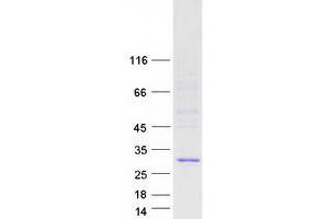 Validation with Western Blot (PMS2L3 Protein (Transcript Variant 1) (Myc-DYKDDDDK Tag))