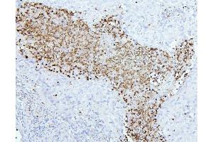 IHC analysis of CEACAM5 using anti-CEACAM5 antibody (ABIN7601435).