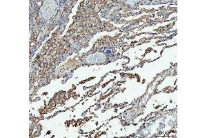 IHC analysis of ACE using anti-ACE antibody (ABIN3043777).