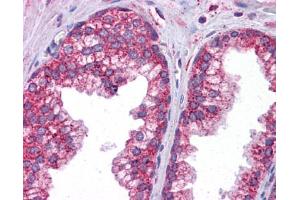 Immunohistochemistry (IHC) image for anti-Signal Transducer and Activator of Transcription 6, Interleukin-4 Induced (STAT6) (C-Term) antibody (ABIN486817) (STAT6 Antikörper  (C-Term))