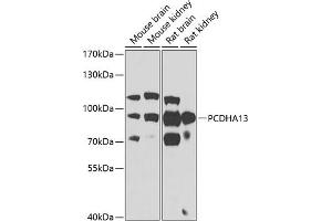 Western blot analysis of extracts of various cell lines, using PCDH antibody (ABIN6129639, ABIN6145299, ABIN6145300 and ABIN6223365) at 1:1000 dilution. (PCDHa13 Antikörper  (AA 300-360))