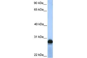 WB Suggested Anti-SIGLEC12 Antibody Titration:  0.