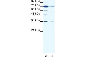 WB Suggested Anti-SMAD4 Antibody Titration:  1. (SMAD4 Antikörper  (Middle Region))