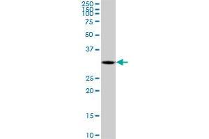 DECR2 monoclonal antibody (M03), clone 4A7. (DECR2 Antikörper  (AA 49-109))