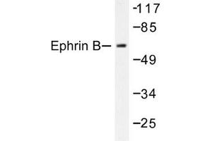 Image no. 1 for anti-Ephrin B1 (EFNB1) antibody (ABIN271886) (Ephrin B1 Antikörper)