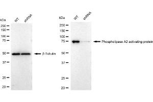 Western blotting analysis using Phospholipase A2 activating protein antibody (ABIN7799820).