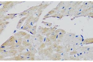 Immunohistochemistry of paraffin-embedded Mouse heart using FGFR2 Polyclonal Antibody at dilution of 1:100 (40x lens). (FGFR2 Antikörper)