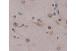 IHC-P analysis of Human Tissue, with DAB staining. (E2F2 Antikörper  (AA 129-429))