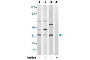 Western blot analysis of extracts from A-549 cells (Lane 1), LoVo cells (Lane 2) and K-562 cells (Lane 3 and lane 4), using CA5A polyclonal antibody . (CA5A Antikörper)
