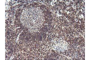Immunohistochemical staining of paraffin-embedded Human tonsil using anti-PDLIM2 mouse monoclonal antibody. (PDLIM2 Antikörper)