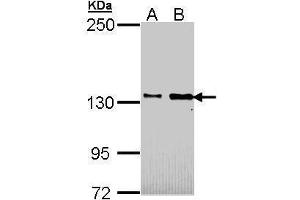 WB Image Sample (30 ug of whole cell lysate) A: H1299 B: Hela 5% SDS PAGE antibody diluted at 1:1000 (CDON Antikörper  (N-Term))