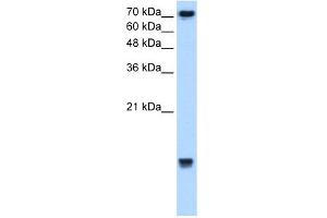 WB Suggested Anti-UBE2N Antibody Titration:  2. (UBE2N Antikörper  (Middle Region))