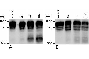 Western blotting analysis of PMA-activated neutrophils (A) and monocytes (B), using anti-human CD18 (MEM-148). (Integrin beta 2 Antikörper)