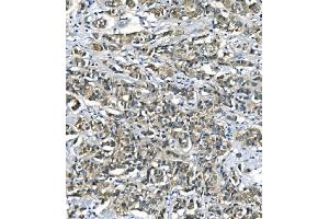 IHC analysis of ASS1 using anti-ASS1 antibody (ABIN7601191). (ASS1 Antikörper  (AA 3-365))