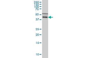 Western Blotting (WB) image for anti-Casein Kinase 1, gamma 1 (CSNK1G1) (AA 293-393) antibody (ABIN599256) (CSNK1G1 Antikörper  (AA 293-393))