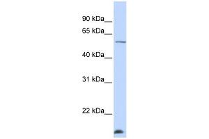 WB Suggested Anti-WDR40A Antibody Titration:  0. (DCAF12 Antikörper  (N-Term))