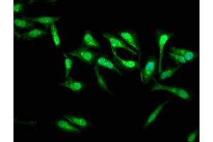 Immunofluorescence staining of Hela cells with ABIN7165980 at 1:133, counter-stained with DAPI. (SSH3 Antikörper  (AA 480-659))