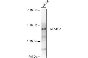 Western blot analysis of extracts of Jurkat cells, using (ABIN3017384, ABIN3017385, ABIN3017386 and ABIN6220063) at 1:1000 dilution. (NFAT1 Antikörper)