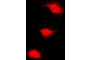 Immunofluorescent analysis of CHK1 (pS301) staining in HeLa cells.