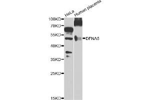 Western blot analysis of extracts of various cell lines, using DFNA5 Antibody. (DFNA5 Antikörper)