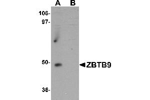 Western Blotting (WB) image for anti-Zinc Finger and BTB Domain Containing 9 (ZBTB9) (C-Term) antibody (ABIN1030815) (ZBTB9 Antikörper  (C-Term))