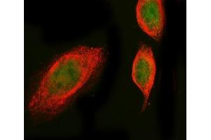 IF analysis of PROX1 using anti-SGT1/ECD antibody (ABIN7601937) and anti-Tubulin Alpha antibody (ABIN7600339). (PROX1 Antikörper  (AA 51-737))