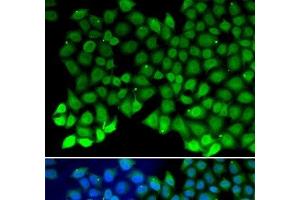 Immunofluorescence analysis of MCF-7 cells using RPA1 Polyclonal Antibody (RPA1 Antikörper)