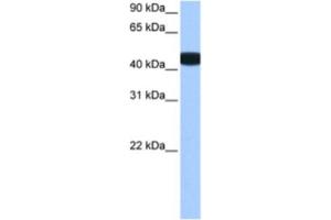 Western Blotting (WB) image for anti-Branched Chain Ketoacid Dehydrogenase Kinase (BCKDK) antibody (ABIN2463496) (BCKDK Antikörper)