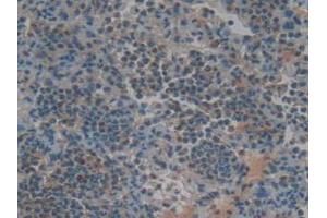 IHC-P analysis of Rat Lung Tissue, with DAB staining. (TNFRSF11A Antikörper  (AA 31-214))