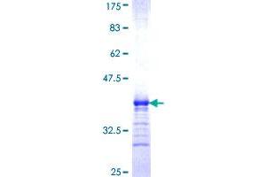 Image no. 1 for Serotonin Receptor 1B (HTR1B) (AA 1-49) protein (GST tag) (ABIN1307259)