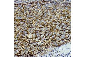 Immunohistochemistry (IHC) image for anti-Integrin alpha M (ITGAM) (AA 145-340) antibody (ABIN3022180)