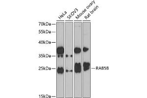 Western blot analysis of extracts of various cell lines, using RB antibody (ABIN6128601, ABIN6146597, ABIN6146598 and ABIN6223325) at 1:1000 dilution. (RAB5B Antikörper  (AA 1-215))