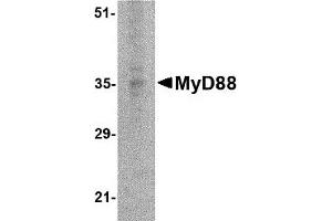 Western Blotting (WB) image for anti-Myeloid Differentiation Primary Response Gene (88) (MYD88) antibody (ABIN1031779) (MYD88 Antikörper)