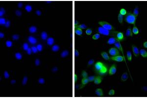 Human pancreatic carcinoma cell line MIA PaCa-2 was stained with Mouse Anti-Cytokeratin 18-UNLB and DAPI.