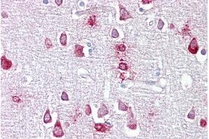 Immunohistochemistry with Brain, cortex tissue at an antibody concentration of 5µg/ml using anti-PPME1 antibody (ARP56845_P050) (PPME1 Antikörper  (N-Term))