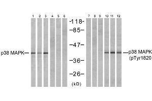 Western blot analysis of extracts from NIH-3T3 (Line 1, 4, 7 and 10) and COS7 (Line 2, 5, 8 and 11 and K562 (Line 3, 6, 9 and 12) cells, untreated or treated with (MAPK14 Antikörper)