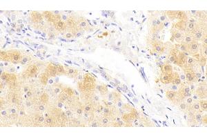 Detection of SAA2 in Human Liver Tissue using Polyclonal Antibody to Serum Amyloid A2 (SAA2) (SAA2 Antikörper  (AA 19-122))