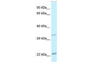 WB Suggested Anti-Pdx1 Antibody Titration: 1. (PDX1 Antikörper  (N-Term))